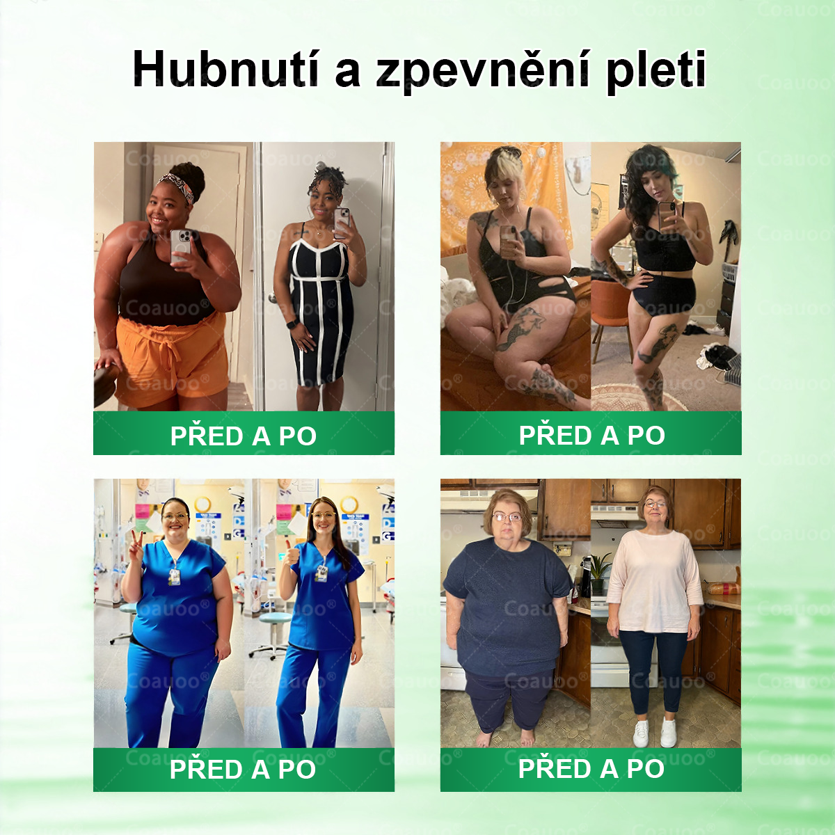 Oficiální prodejna  |  🧑‍⚕️𝐂𝐨𝐚𝐮𝐨𝐨® 𝐌𝐨𝐫𝐢𝐧𝐠𝐚 × 𝐁𝐞𝐫𝐛𝐞𝐫𝐲𝐧𝐚 × 𝐀𝐌𝐏𝐊 𝟏𝟎 v 1 – Zeštíhlující nano mikrojihlový náplast 🇨🇿 Jen 1× denně ✅ Viditelné změny za 7 dní – na obezitu, kardiovaskulární zdraví, diabetes a kloubní problémy